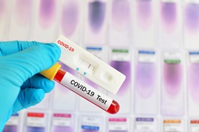 Λάρισα: 10 θετικά δείγματα στον κορωνοϊό στα σημερινά rapid tests