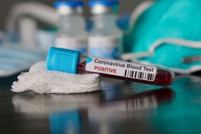 Mειωμένα τα κρούσματα κορωνοϊού στη Λάρισα - 58 νέες μολύνσεις 