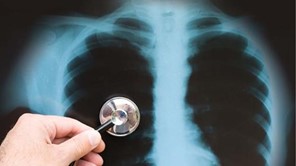 Λάρισα: To Σάββατο η επιστημονική ημερίδα για τη φυματίωση 