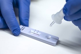 Λάρισα: 28 κρούσματα κορωνοϊού έδειξαν τα rapid tests