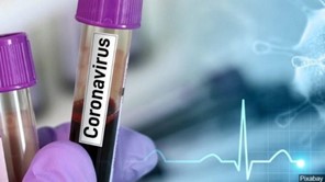 Παραμένει μεγάλη η διασπορά του ιού - 159 νέα κρούσματα στη Λάρισα 