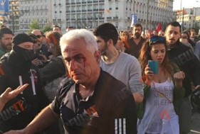 Θύμα ξυλοδαρμού στην Αθήνα ο Χρήστος Σιδερόπουλος (VIDEO)