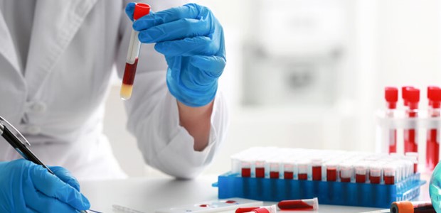 Κλείνουν τα μικροβιολογικά και διαγνωστικά εργαστήρια