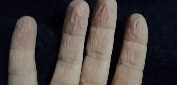 "Σεβαστείτε κάποιους που πραγματικά υποφέρουν"