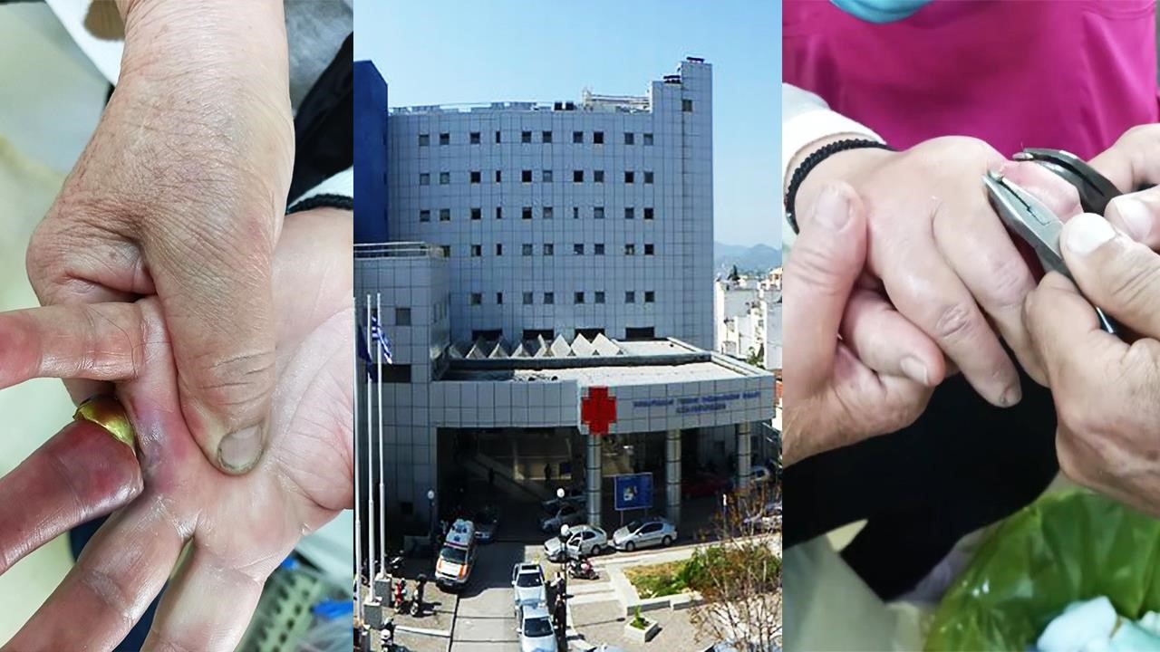 Ο χρυσοχόος που διασώζει δάχτυλα πολιτών