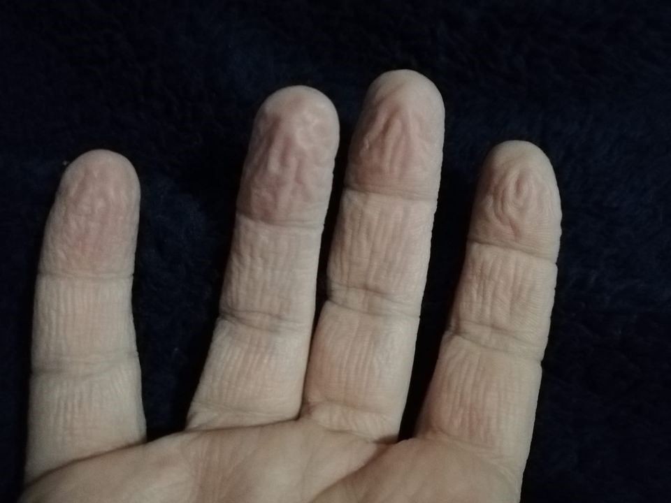 "Σεβαστείτε κάποιους που πραγματικά υποφέρουν"