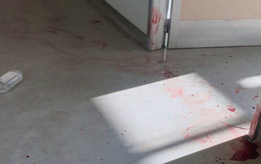 59χρονος μαχαίρωσε νοσηλεύτρια και βούτηξε στο κενό