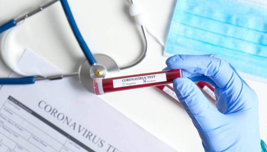 Ένα ακόμη θετικό κρούσμα κορωνοϊού