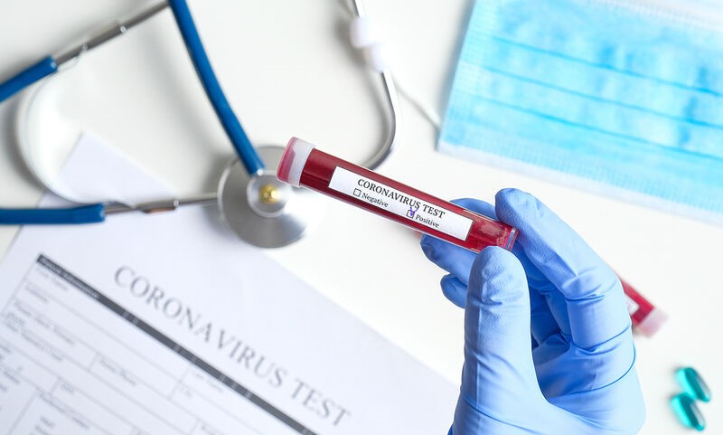 Κορωνοϊός: Τρεις θάνατοι σε ένα 24ωρο, 108 στο σύνολο