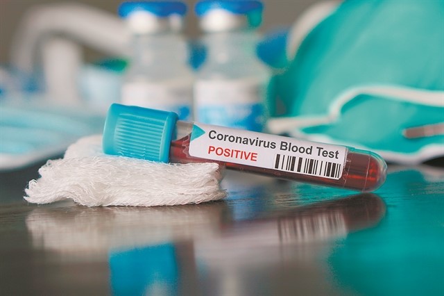 Δωρεάν εξέταση εκπαιδευτικών για Covid-19