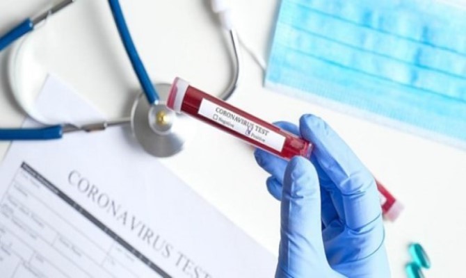 262 νέα κρούσματα σε 24 ώρες στην Ελλάδα