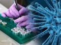 Έκρηξη λοιμωδών νοσημάτων  Έκρηξη λοιμωδών νοσημάτων