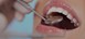Επιστημονική ημερίδα του Οδοντιατρικού Συλλόγου Τρικάλων