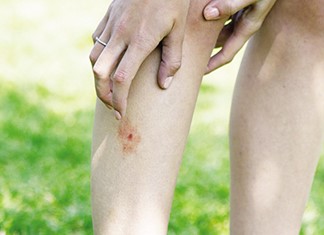 Εντομοαπωθητικό σε νέα μορφή μους Εντομοαπωθητικό σε νέα μορφή μους